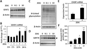 Drdo scientist anant narayan bhatt explains how 2dg drug helps body to fight with covid 19 the drug has been developed by institute of nuclear medicine and allied sciences (inmas), a leading. 2 Deoxy D Glucose Increases Gfat1 Phosphorylation Resulting In Endoplasmic Reticulum Related Apoptosis Via Disruption Of Protein N Glycosylation In Pancreatic Cancer Cells Sciencedirect