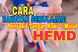 Apa saja penyebab kaki bengkak? Cara Rawatan Semulajadi Penyakit Tangan Kaki Dan Mulut Hfmd Pengedar Shaklee Ipoh Perak