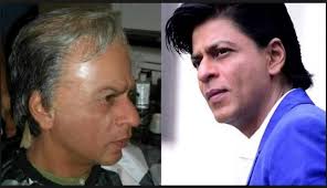 Do You Know These Popular Celebs Are A Victim Of Baldness Supported By Hair Transplant Treatment Newstrack English 1 Salman khan bald pics ❤. hair transplant treatment