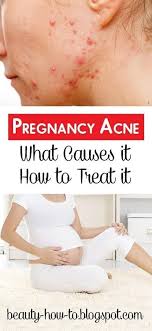 Pin On Beauty Tips