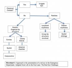 Image result for Acute Red Eye