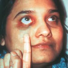 Putting patients at the centre