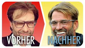Regenera activa (otolog mikrogreft) haar. Der Grund Fur Seinen Erfolg Jurgen Klopp Youtube