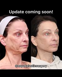 Nayak Plastic Surgery added a new...