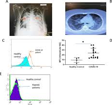 Here is the solution for happy glass level 103. Silent Hypoxia Higher No In Red Blood Cells Of Covid 19 Patients Bmc Pulmonary Medicine Full Text