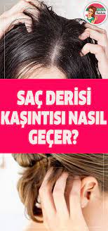Sac Derisi Kasintisi Nasil Gecer Health Health Fitness Engagement