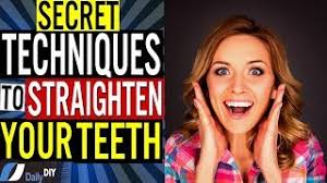 Companies offer financing plans with payments under. How Can I Push My Teeth Back Without Braces
