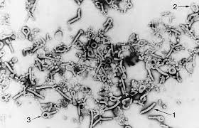 Marburg virus disease was initially detected in 1967 after simultaneous outbreaks in marburg and frankfurt in germany; Marburg Virus Particles Purified From The Blood Of Infected Guinea Download Scientific Diagram