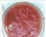 E. coli on MacConkey agar. Note the pinkish colonies | Download ...