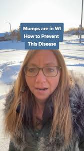 MUMPS IN WISCONSIN