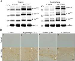 Check spelling or type a new query. Conditional Inactivation Of Akt Three Isoforms Causes Tau Hyperphosphorylation In The Brain Molecular Neurodegeneration Full Text