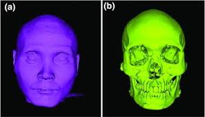 Standard viewing options including mpi are also available. Virtual Facial Reconstruction Based On Accurate Registration And Fusion Of 3d Facial And Msct Scans Springerlink