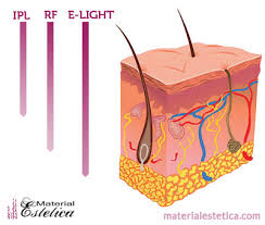 That's because there's no hair on the surface to absorb the light energy. Benefits Of E Light Intense Pulsed Light Ipl And Radio Frequency Material Estetica Blog