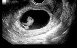 Why is there no heartbeat at 7 weeks?