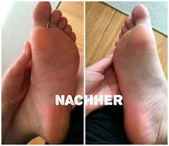 Woman Testet Fussmaske Durch Die Sich Die Haut Ablost Woman At