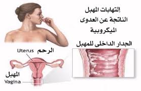 اسماء الفرج بالصور كنج كونج