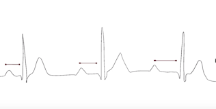 Acls, Acls, Acls - Practical Application, Acls Training Flashcards | Quizlet