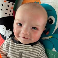 1st Successful Partial Heart Transplant Performed in Baby Boy