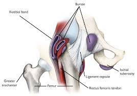 In the low back, hip, buttocks (especially immediately under the buttocks), side of the thigh, hamstrings. Snapping Hip Orthoinfo Aaos