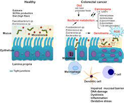 Bănuiești că ai rămas însărcinată și acest lucru îți creează emoții? Frontiers Aspects Of Gut Microbiota And Immune System Interactions In Infectious Diseases Immunopathology And Cancer Immunology