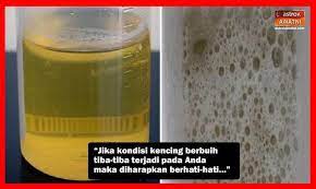 Kencing berbusa bisa jadi tanda adanya penyakit ginjal dan jantung. Klinik Avicenna Kencing Berbuih Punca Kencing Berbuih Facebook
