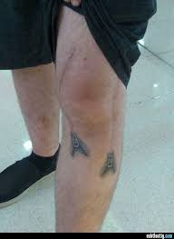 Narbe Wird Zum Reissverschluss Knietattoo Reissverschluss Tatoo