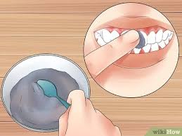 One of such health hazards are the white spots on teeth and the gradual tooth decay. 3 Ways To Get Rid Of White Spots On Teeth Wikihow