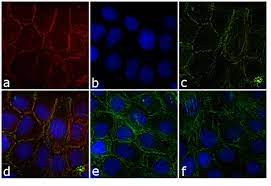 The alexa fluor family of fluorescent dyes is a series of dyes invented by molecular probes, now a part of thermo fisher scientific, and sold under the invitrogen brand name. Goat Anti Rabbit Igg H L Highly Cross Adsorbed Alexa Fluor 680 A 21109