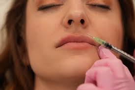 Why 'Lip Flip' Filler Treatment Is 'Popular': Dr Will Kirby Explains