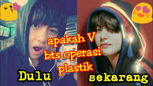 Apakah V Bts Operasi Plastik Foto Foto Muda V Bts Youtube
