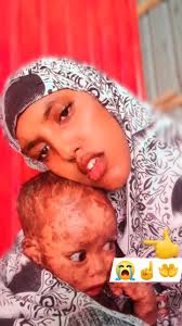 Naxarista ayaa ka guurtay dadkena somaaliyed waan calool xumoday wllhi  allow u caafi wiilka yar.😭😭😭