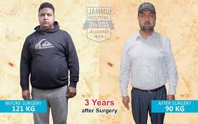Pin On Bariatric Surgery India Punjab