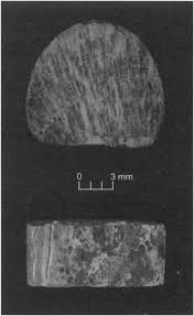 Cross section of a bone. Side And Cross Section View Of The Portion Of Bone That Was Removed Download Scientific Diagram
