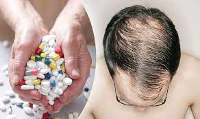 Hair loss can be a terrible experience and a lot of men are troubled by this in their life. How To Prevent Hair Loss Expert Reveals Best Anti Balding Treatments Express Co Uk