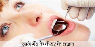 86% of cases are diagnosed in those over 50. Mouth Cancer Symptoms In Hindi à¤œ à¤¨ à¤® à¤¹ à¤• à¤• à¤¸à¤° à¤• à¤²à¤• à¤·à¤£