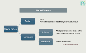 Jul 20, 2021 · x lung cancer is the leading cause of cancer death in the united states, and globally 1. Epos