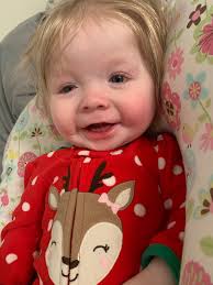 The Silver Butterfly: Agenesis of the Corpus Callosum Awareness A. (ACCAA)