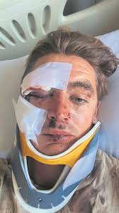 Muizenberg family are raising funds to bring injured local home from Bali