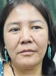 Teen's pain 'ignored': advocate