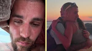 Justin Bieber shared selfies to Instagram, telling his close to 300M  followers that he was detoxing. He did not share what he was detoxing from,  but the new snaps furthered fan concern