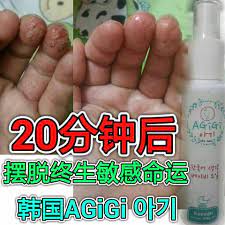 终生天生敏感的我 最痛苦每个女人都想拥有一双玉手可是你看我的手像什么 用过无数产品 擦了还是不会好 没想到一生人中竟然遇上这个才rm128 那么便宜的韩国agigi精油喷雾让我成功摆脱敏感手这个前 convenience store products convenience store pill