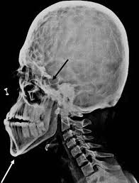 Mar 21, 2021 · librivox about. Https Clinicalimagingscience Org View Pdf 1 Article A0bd56b639de1a029ea5e3ac3532e26e3xiu2q 3d 3d