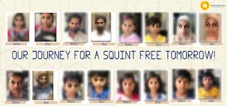 Squint Treatment Without Surgery In India Sanjeevan