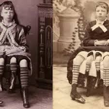 Discover the magic of the internet at imgur, a community powered entertainment destination. Conheca Josephine Myrtle Corbin A Mulher De Quatro Pernas Noticias Bol
