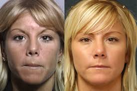 Daniel Daube, MD Reviews, Before and After Photos, Answers