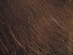 Image result for lice vs dandruff