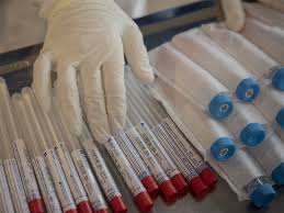 Corona schnelltest kaufen, antigen schnelltest kaufen, covid19 schnelltest kaufen,. Global Companies Extend A Hand With 1 Million Covid 19 Test Kits The Economic Times