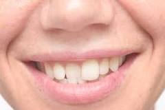 Image result
