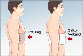 Rippenprellung Ursachen Symptome Behandlung Medlexi De