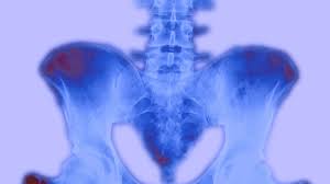 Image result for Low Back Imaging